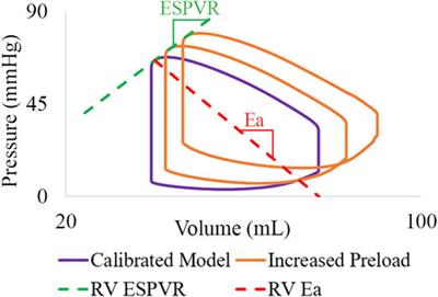 Data-driven computational models of ventricular-arterial hemodynamics in pediatric pulmonary arterial hypertension